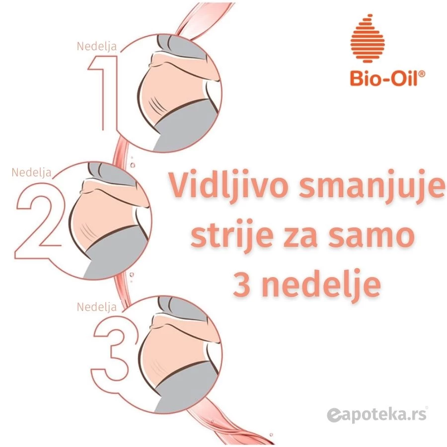 Bio-Oil® Gel Ulje za Negu Kože 100 mL Protiv Strija, Ožiljaka i Suve Kože