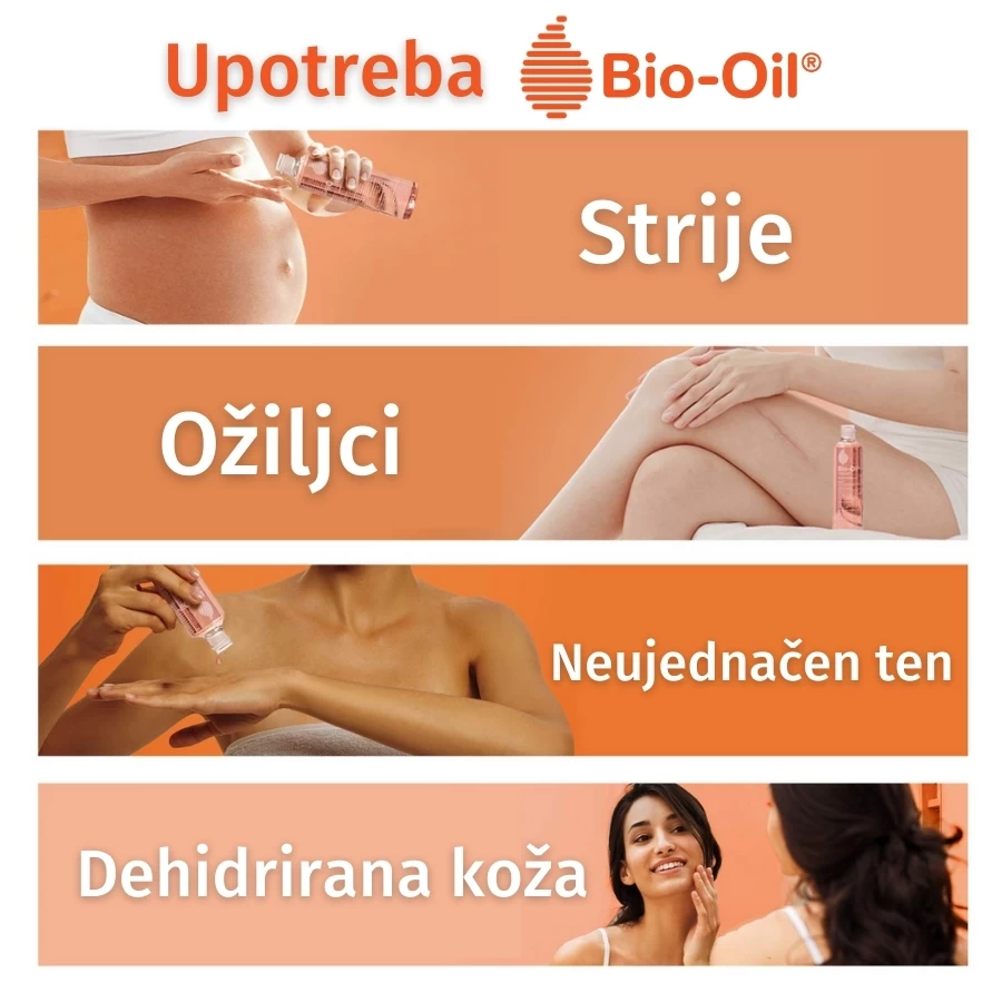 Bio-Oil® Suvo Ulje za Negu Kože 25 mL