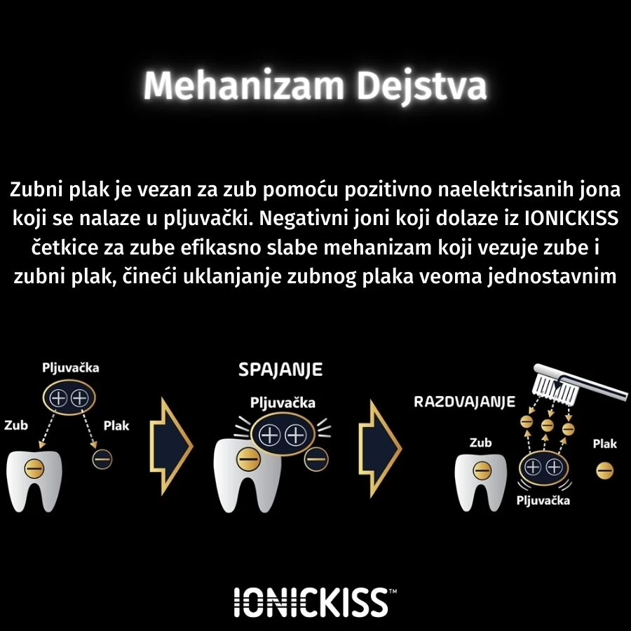 IONICKISS™ IONPA Električna Jonizirajuća Četkica za Zube BISERNO BELA