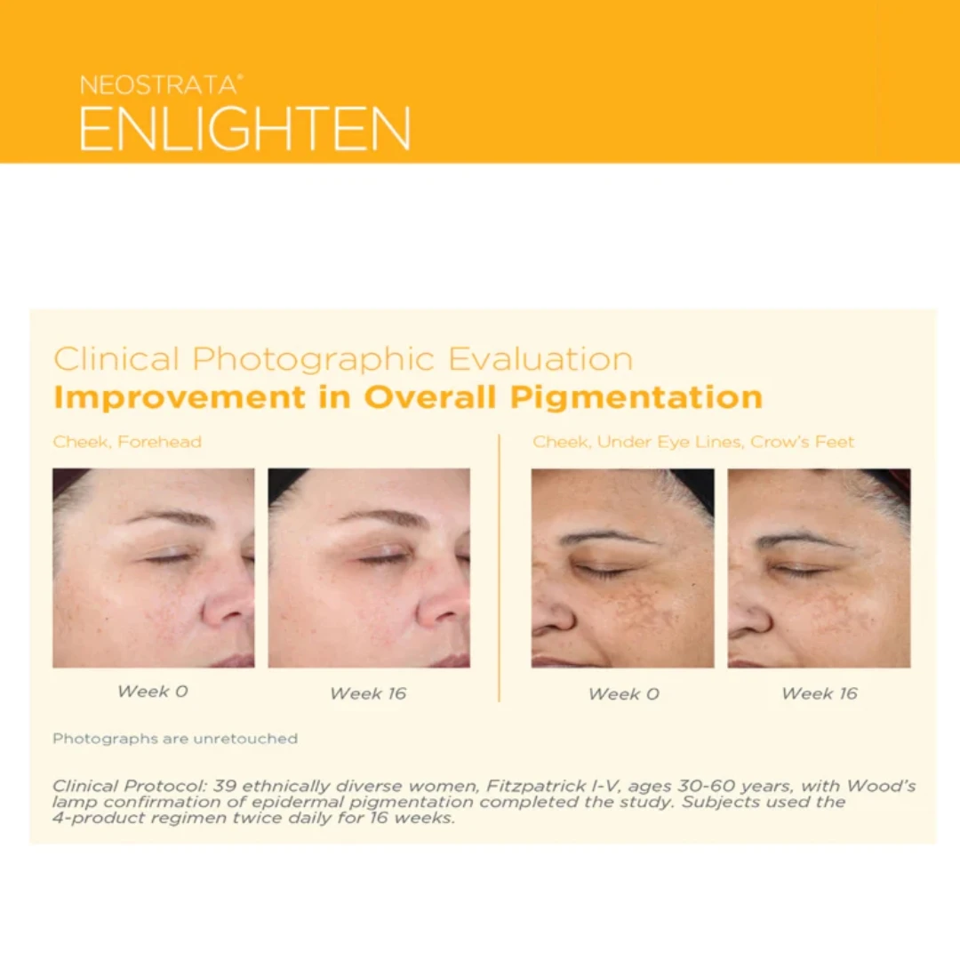 NEOSTRATA® ENLIGHTEN Pigment Lightening Gel sa 10 AHA i PHA 40 g za