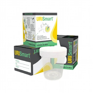 URISmart® Posuda za Uzorkovanje Urina